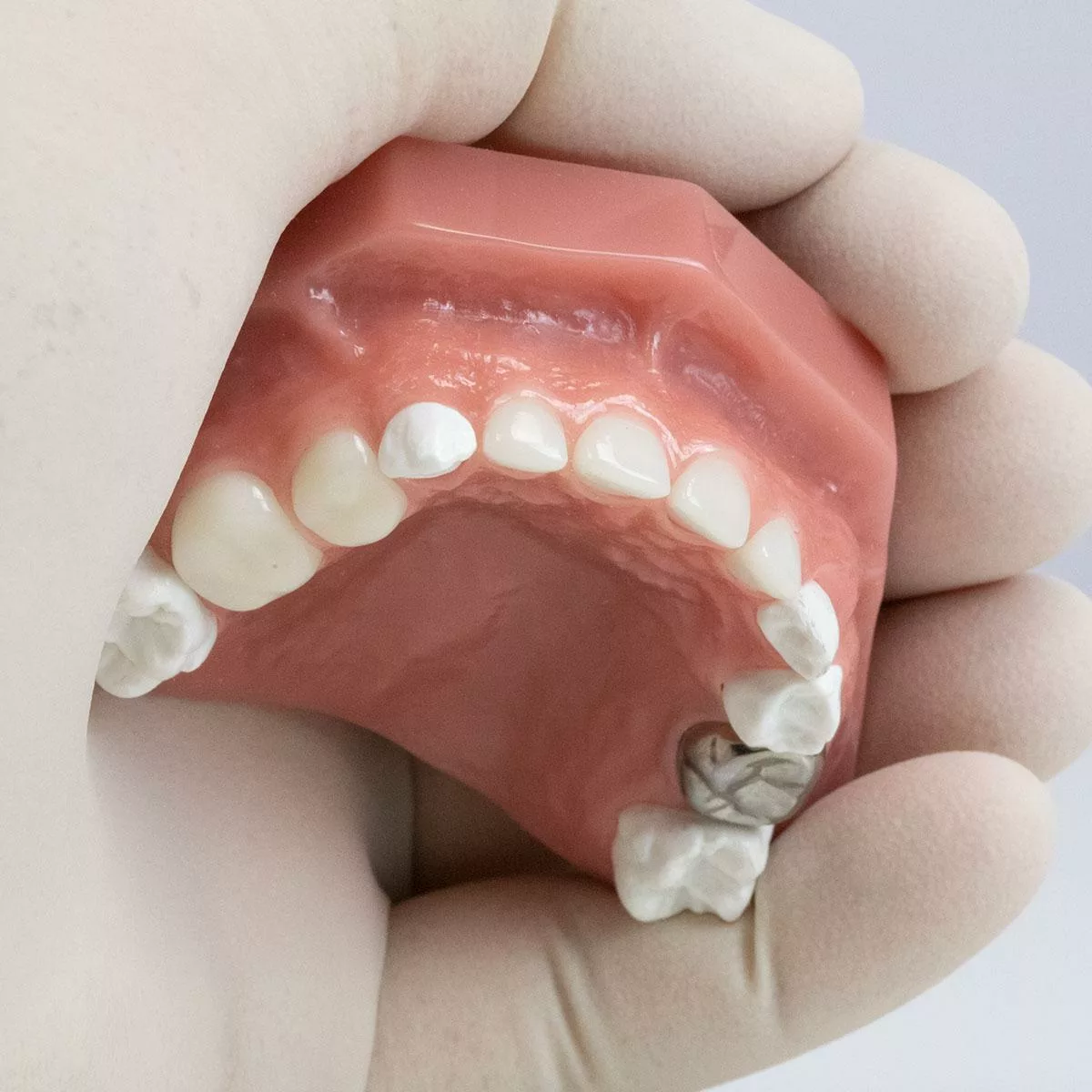 Typodont Sprig Oral Health Technologies, Inc. Store