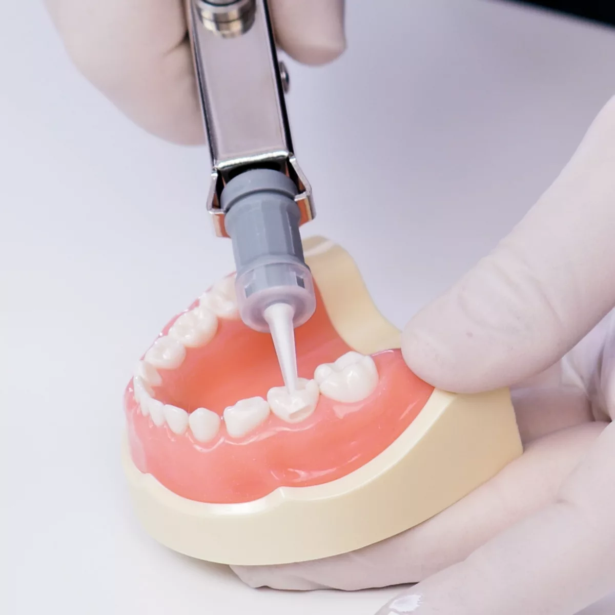 SmartMTA Capsule Sprig Oral Health Technologies, Inc. Store